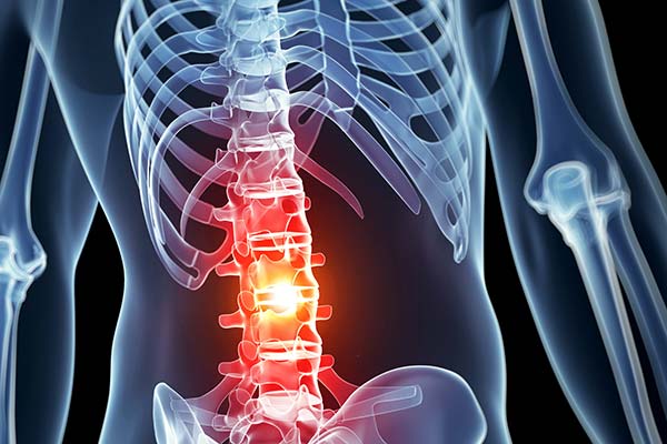spinal injury attorneys sacramento spinal injury attorneys sacramento